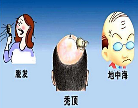 福州植發(fā)怎么收費(fèi)？詳細(xì)了解上榜實(shí)力醫(yī)院有哪些