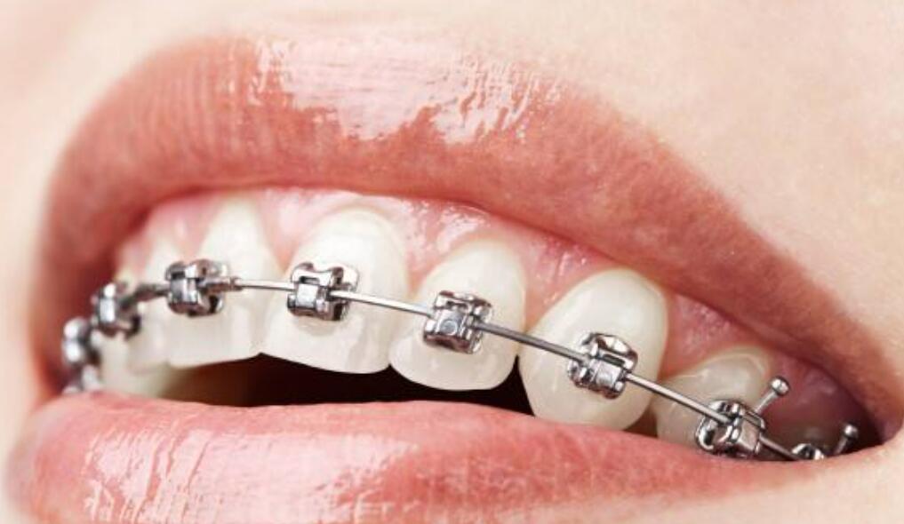 綿陽矯正牙齒的費用是多少?三家人氣牙科醫(yī)院介紹