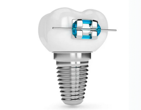 寧波做種植牙價(jià)格多少？醫(yī)院實(shí)力名單出爐