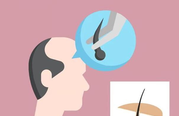 上海毛發(fā)種植多少錢？熱門植發(fā)醫(yī)院上榜