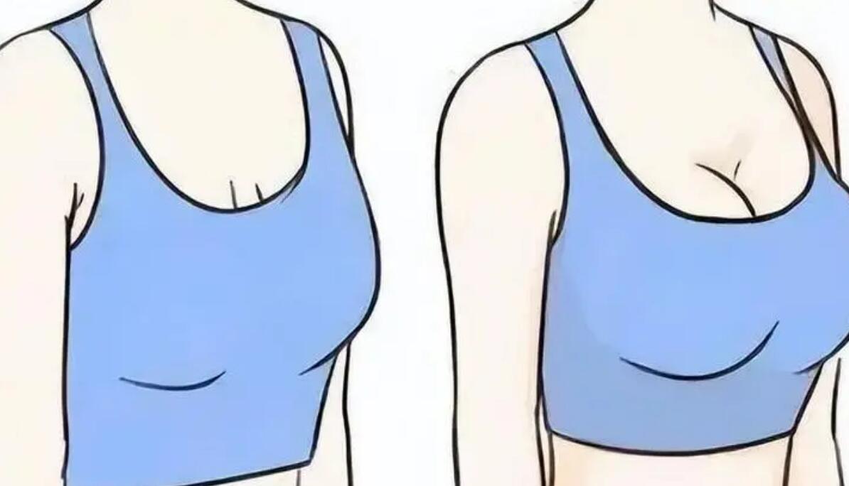 長(zhǎng)沙隆胸手術(shù)價(jià)格多少錢?三家專業(yè)醫(yī)院推薦