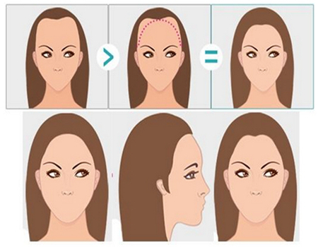 南昌種植頭發(fā)一般多少錢？精選植發(fā)醫(yī)院名單點(diǎn)擊查看