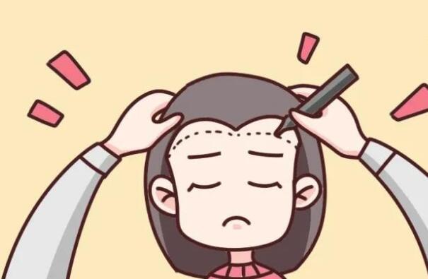 泉州禿頂植發(fā)多少錢？匯總top3頭發(fā)植發(fā)醫(yī)院詳情