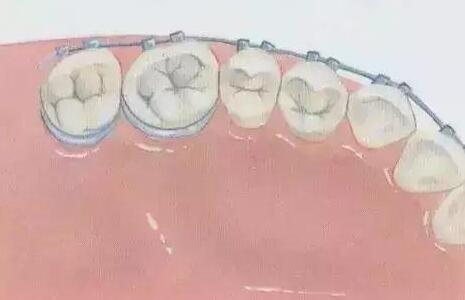 天津矯正牙齒價格是多少？精選top3機構名單