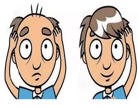 紹興頭發(fā)禿頂植發(fā)要多少錢？口碑毛發(fā)種植醫(yī)院名單匯總