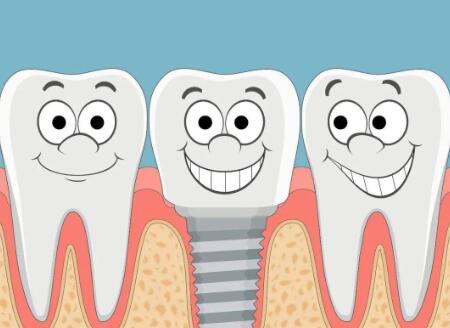 西安種植牙價格是多少？分享前三醫(yī)院排名