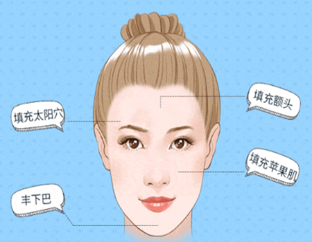 武漢面部填充價格多少錢？武大人民醫(yī)院、中心醫(yī)院以及中西結合醫(yī)院上榜