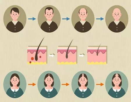 金華種發(fā)際線多少錢？熱門植發(fā)醫(yī)院推薦