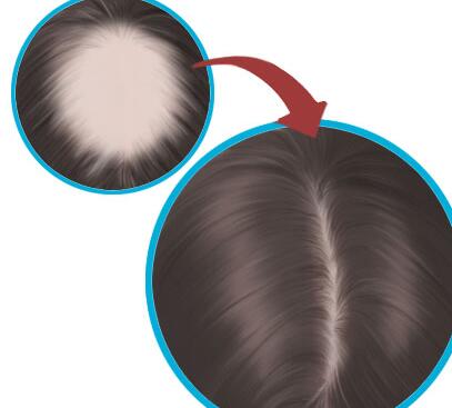 中山無痕植發(fā)價(jià)格大概是多少錢？寶藏毛發(fā)種植醫(yī)院名單出爐