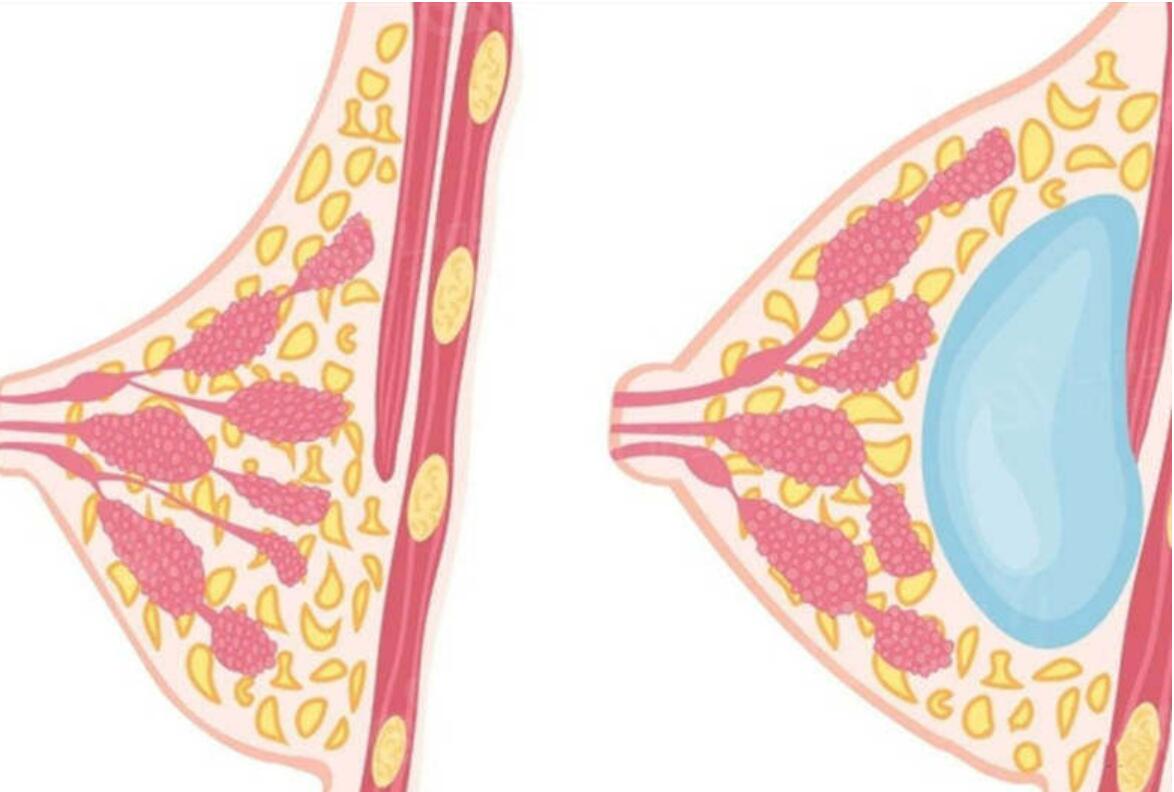 南通曼托隆胸要多少錢?三家人氣整形醫(yī)院強力推薦