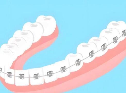 南通矯正牙齒價格是多少？快來看這3家醫(yī)院信息