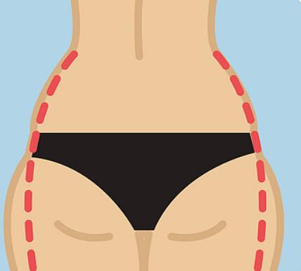 泉州吸脂價格是多少？在線揭曉3家機構(gòu)信息