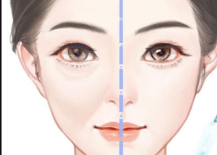 惠州做面部填充價格多少？推薦實力醫(yī)院三家