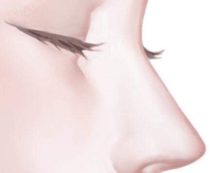 昆明玻尿酸隆鼻多少錢？匯總價格信息和醫(yī)美醫(yī)院資料