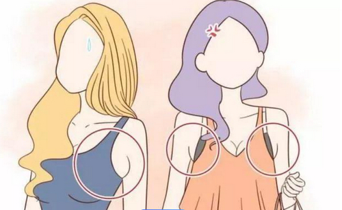 云大醫(yī)院整形科可以隆胸嗎？附硅膠隆胸真人案例介紹