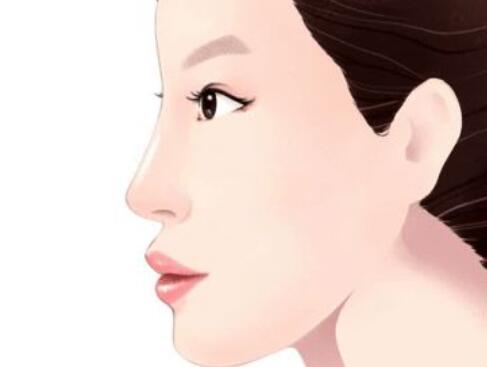 濰坊假體隆鼻需要多少錢(qián)？全新口碑醫(yī)院榜單公布