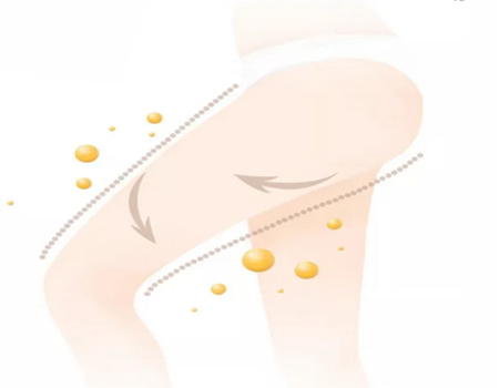 煙臺(tái)大腿吸脂多少錢？口碑醫(yī)美醫(yī)院|價(jià)格參考