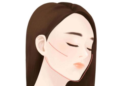 武漢做輪廓固定一般得多少錢(qián)？?jī)?yōu)質(zhì)微整注射醫(yī)院參考