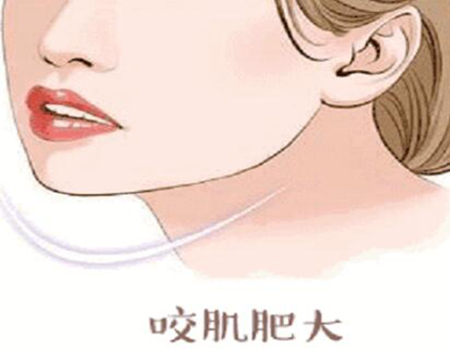 上海磨顴骨價格多少錢 ？磨骨資費-醫(yī)院推薦一覽