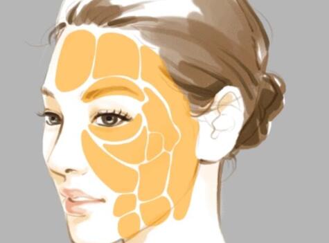 成都面部填充價格是多少？ 參考價格為2000元起