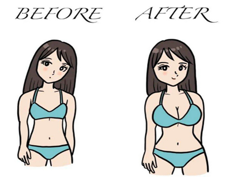 廈門自體隆胸大概需要多少錢？紅榜整形醫(yī)院詳細(xì)匯總