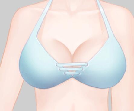 云南曼托隆胸要多少錢？盤點3家人氣整形醫(yī)院