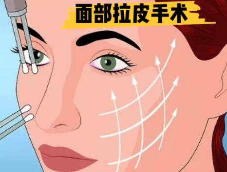 福州面部大拉皮手術(shù)多少錢？整形醫(yī)院哪些好？戳進(jìn)來看