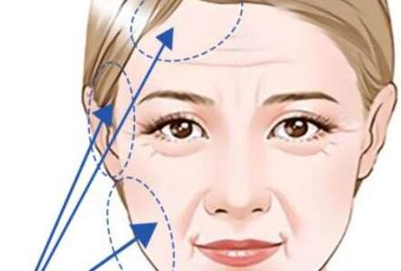 武漢臉部拉皮大概多少錢？匯總價(jià)格詳解|含整形醫(yī)院資料