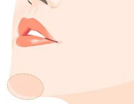 南寧下巴截骨前移價格是多少？參考3家醫(yī)院信息來了