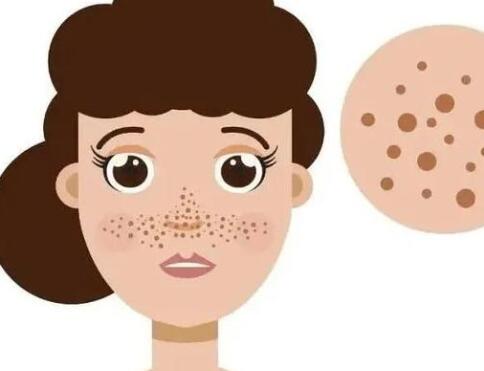 東莞激光祛斑價格是多少？匯總實力醫(yī)院名單