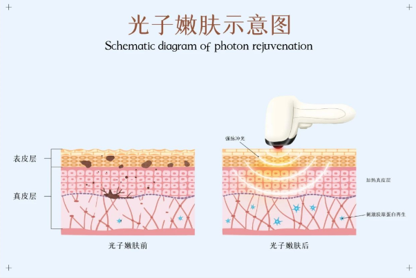 上海中西醫(yī)結(jié)合醫(yī)院醫(yī)療美容科正規(guī)嗎？醫(yī)院信息資料+案例查收