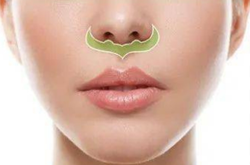 什么人適合做人中縮短